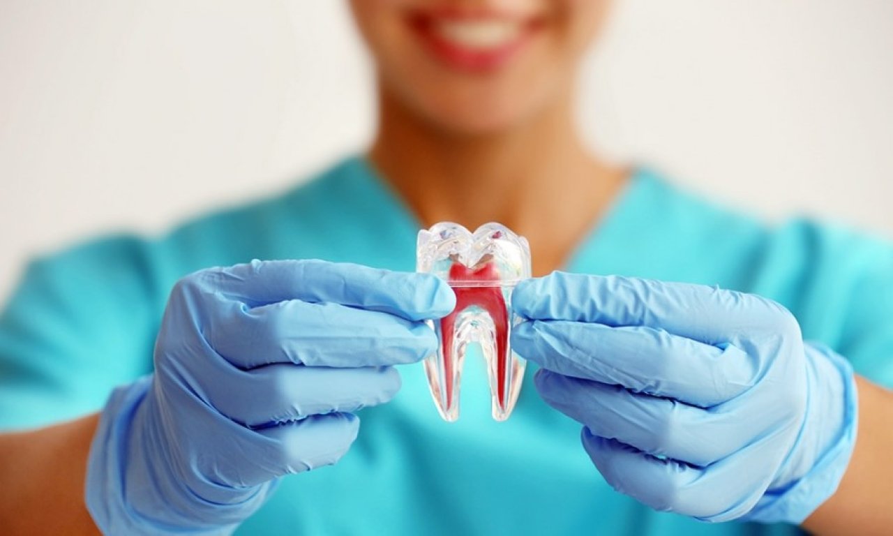 Tratamento de Canal / Endodontia